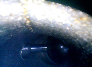 利用HIE系列內(nèi)窺鏡檢測到的某4s店發(fā)動機進氣道圖片